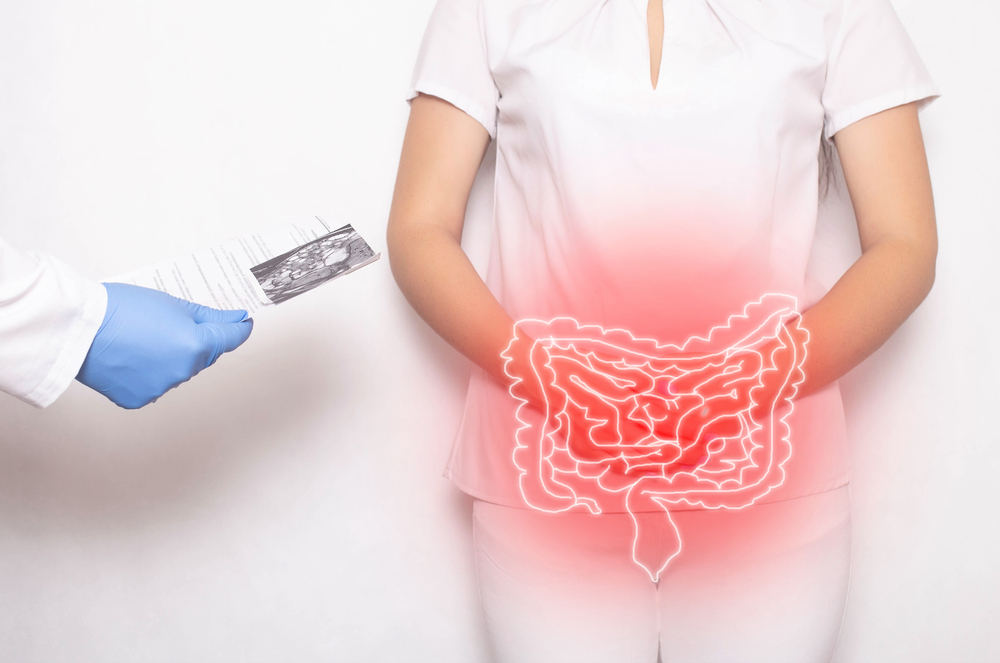 IBD bez hraníc: Crohnova choroba a ulcerózna kolitída nie sú len o zápale čriev