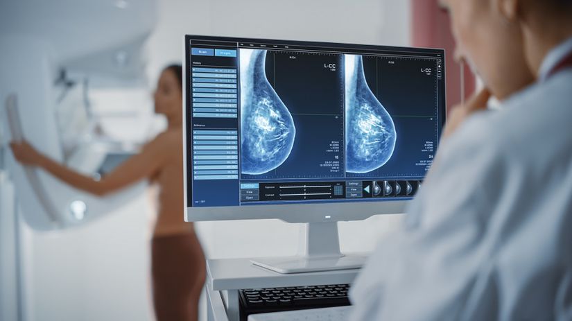 Mamografia odhalí to, čo si nedokážete nahmataťKaždý odložený skríning môže stáť život